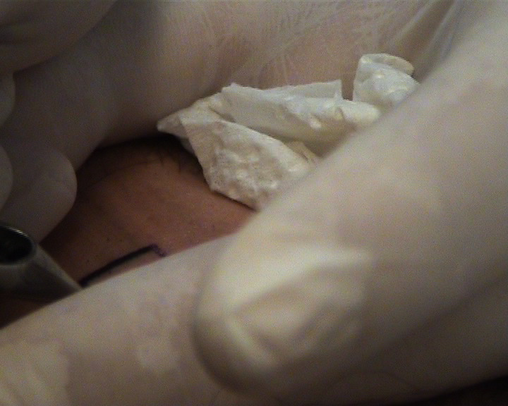 Jeden centimeter štvorcový Jeden centimeter štvorcový
